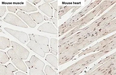 Immunohistochemistry (Formalin/PFA-fixed paraffin-embedded sections) - Anti-Dnmt3a antibody - N-terminal (AB228691)