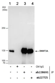 Immunoprecipitation - Anti-Dnmt3a antibody - N-terminal (AB228691)