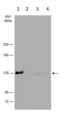 Western blot - Anti-Dnmt3a antibody - N-terminal (AB228691), expandable thumbnail