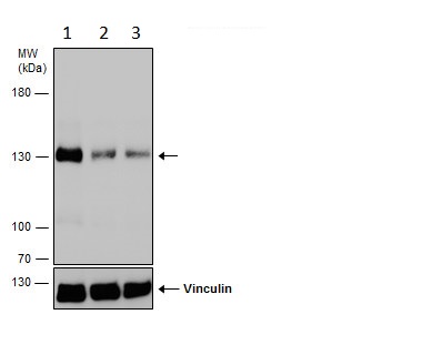 Western blot - Anti-Dnmt3a antibody - N-terminal (ab228691), expandable thumbnail