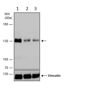 Western blot - Anti-Dnmt3a antibody - N-terminal (AB228691)
