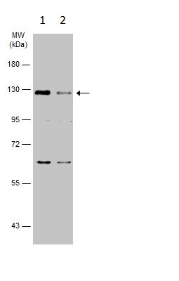 Western blot - Anti-Dnmt3a antibody - N-terminal (ab228691), expandable thumbnail