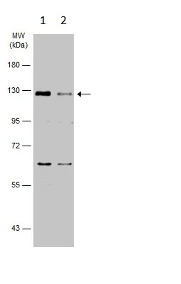 Western blot - Anti-Dnmt3a antibody - N-terminal (AB228691)
