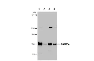 Western blot - Anti-Dnmt3a antibody - N-terminal (AB228691)