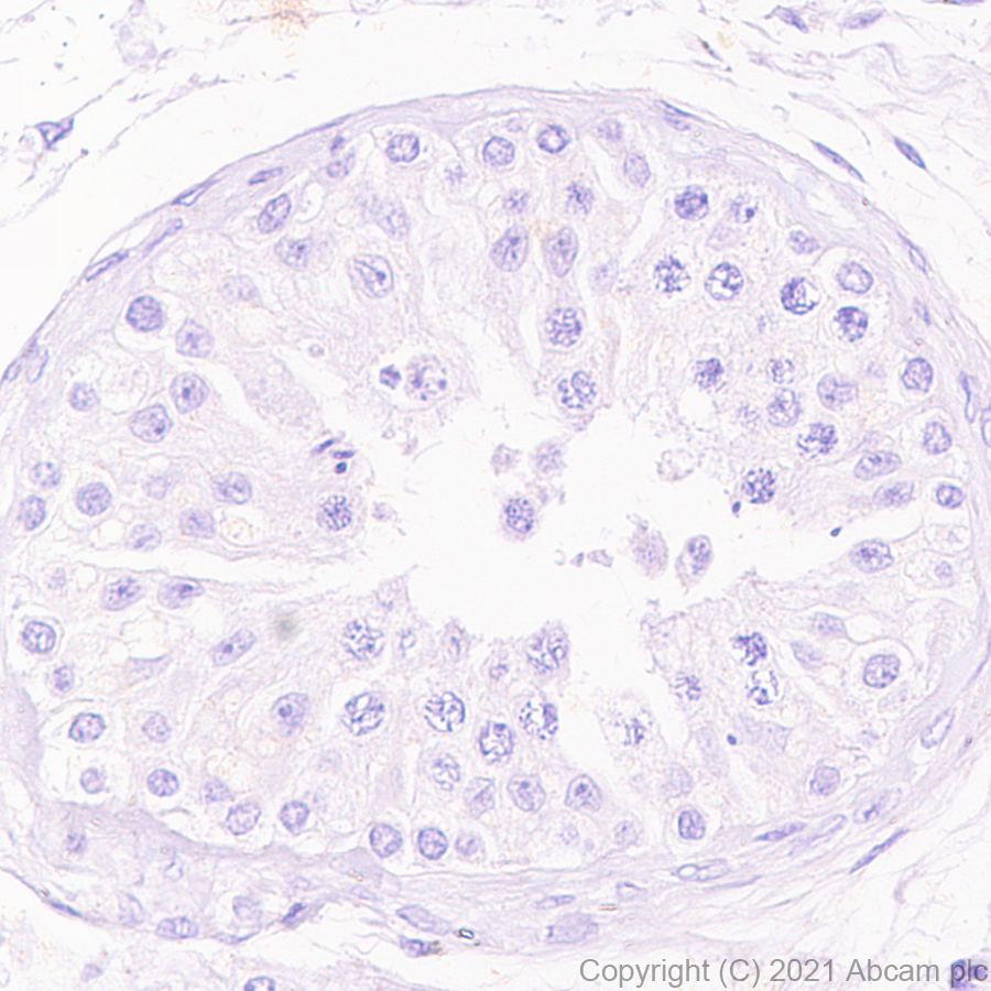 Immunohistochemistry (Formalin/PFA-fixed paraffin-embedded sections) - Anti-Dnmt3a (mutated R882H) antibody [EPR24337-44] (AB271004), expandable thumbnail