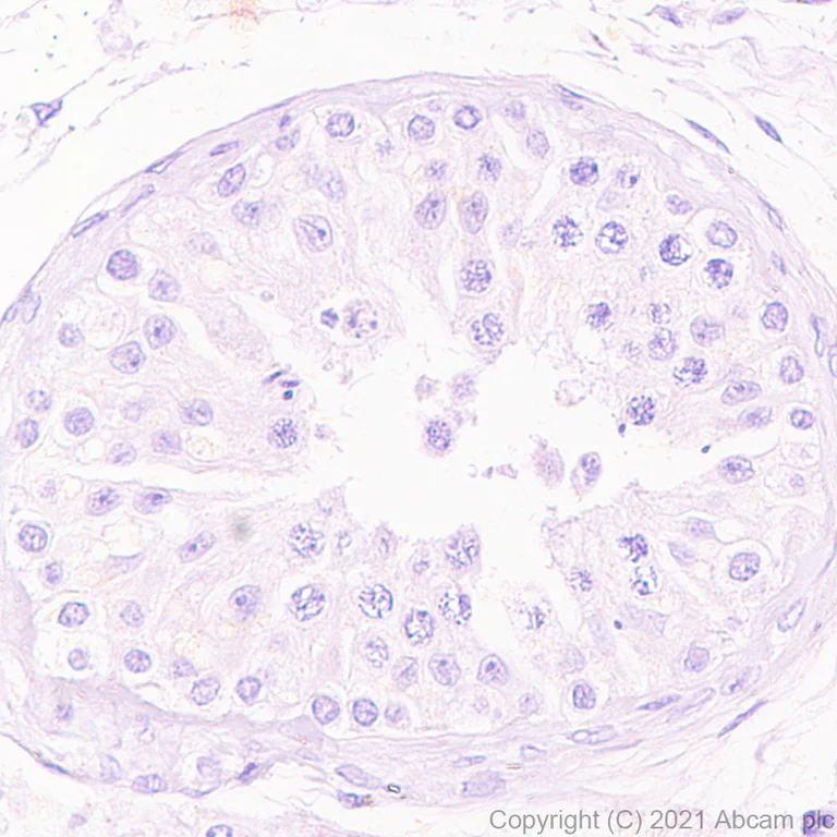 Immunohistochemistry (Formalin/PFA-fixed paraffin-embedded sections) - Anti-Dnmt3a (mutated R882H) antibody [EPR24337-44] (AB271004)