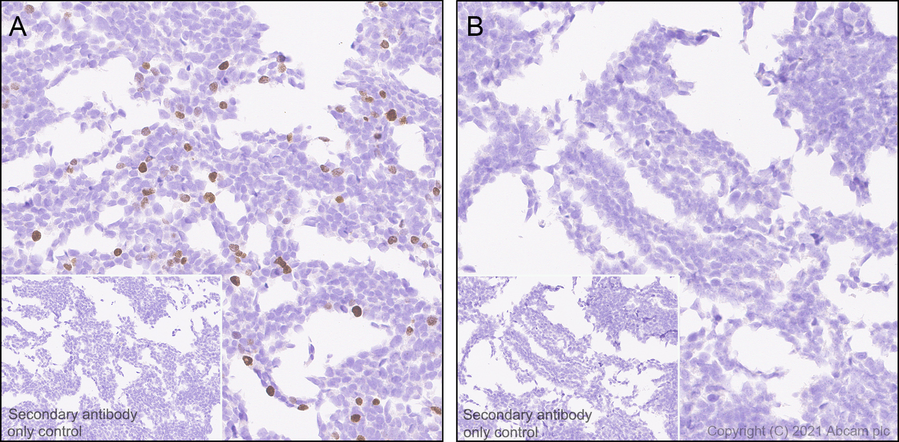Immunohistochemistry (Formalin/PFA-fixed paraffin-embedded sections) - Anti-Dnmt3a (mutated R882H) antibody [EPR24337-44] (AB271004), expandable thumbnail