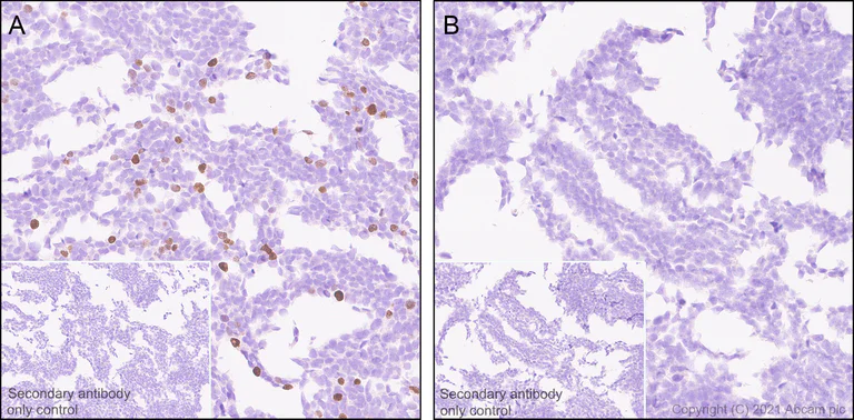 Immunohistochemistry (Formalin/PFA-fixed paraffin-embedded sections) - Anti-Dnmt3a (mutated R882H) antibody [EPR24337-44] (AB271004)