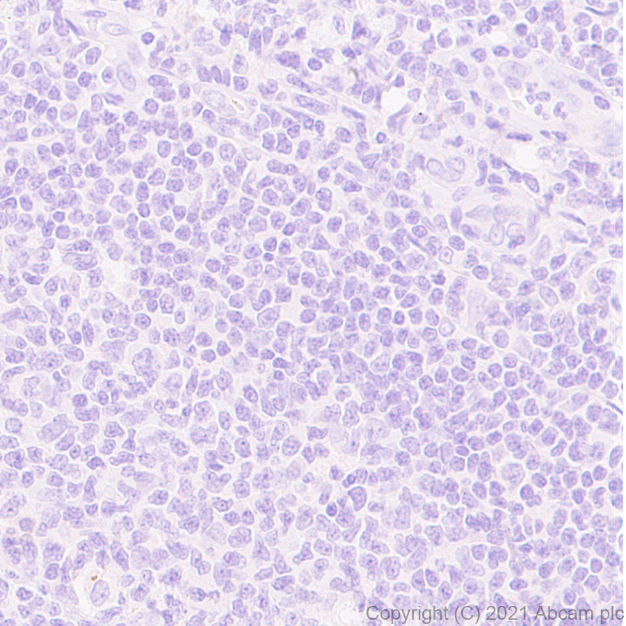 Immunohistochemistry (Formalin/PFA-fixed paraffin-embedded sections) - Anti-Dnmt3a (mutated R882H) antibody [EPR24337-44] (AB271004), expandable thumbnail