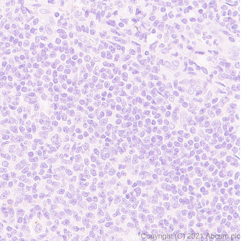 Immunohistochemistry (Formalin/PFA-fixed paraffin-embedded sections) - Anti-Dnmt3a (mutated R882H) antibody [EPR24337-44] (AB271004)