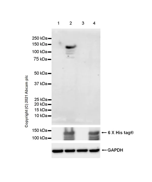 Western blot - Anti-Dnmt3a (mutated R882H) antibody [EPR24337-44] (AB271004)