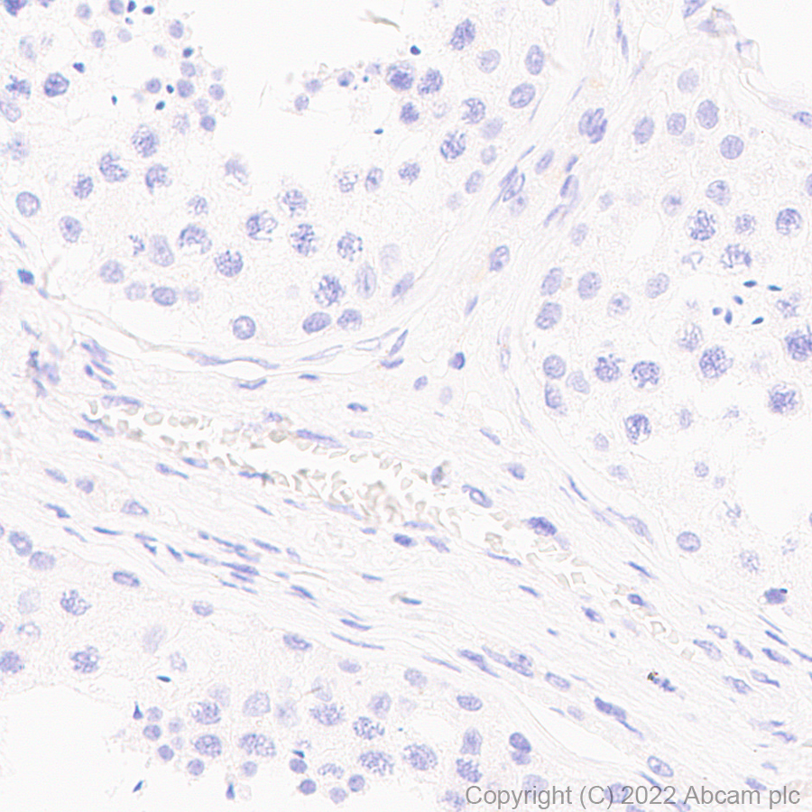Immunohistochemistry (Formalin/PFA-fixed paraffin-embedded sections) - Anti-Dnmt3a (mutated R882H) antibody [EPR27389-11] (AB307540), expandable thumbnail