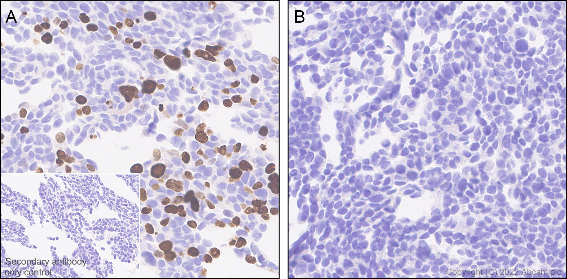 Immunohistochemistry (Formalin/PFA-fixed paraffin-embedded sections) - Anti-Dnmt3a (mutated R882H) antibody [EPR27389-11] (AB307540), expandable thumbnail