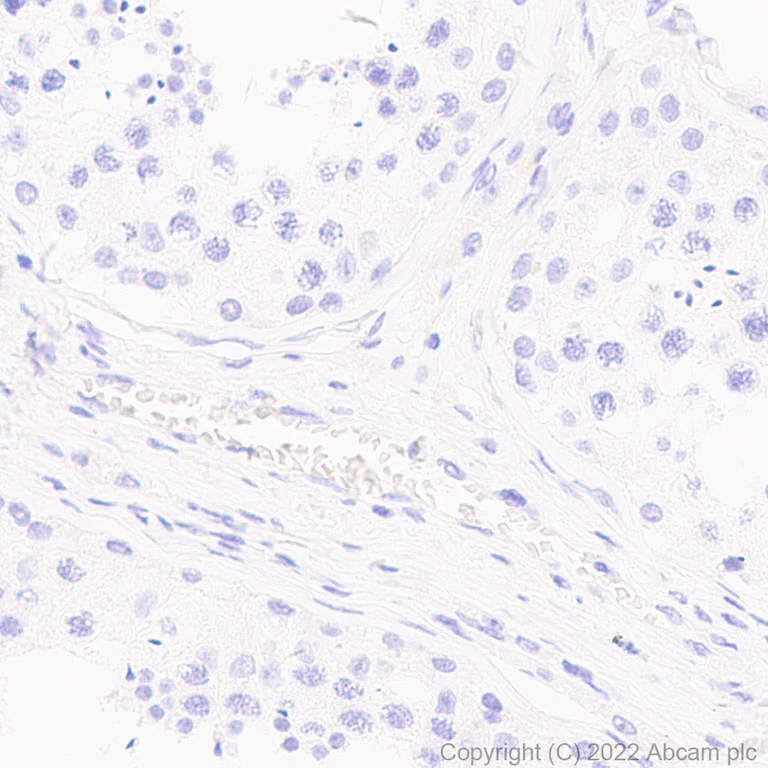 Immunohistochemistry (Formalin/PFA-fixed paraffin-embedded sections) - Anti-Dnmt3a (mutated R882H) antibody [EPR27389-11] - BSA and Azide free (AB307541)