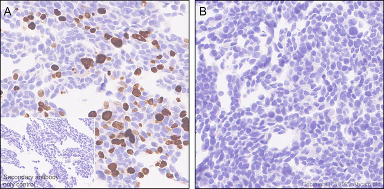 Immunohistochemistry (Formalin/PFA-fixed paraffin-embedded sections) - Anti-Dnmt3a (mutated R882H) antibody [EPR27389-11] - BSA and Azide free (AB307541)