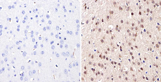 Immunohistochemistry (Formalin/PFA-fixed paraffin-embedded sections) - Anti-Dnmt3b antibody (AB2851)