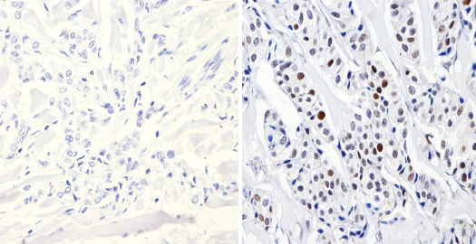 Immunohistochemistry (Formalin/PFA-fixed paraffin-embedded sections) - Anti-Dnmt3b antibody (AB2851)