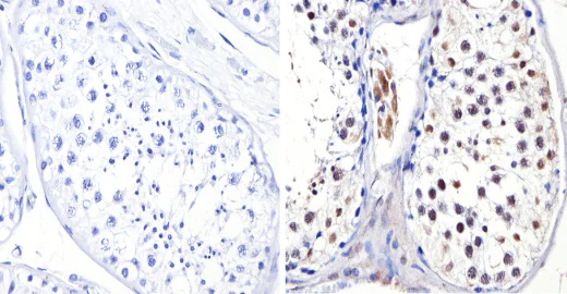 Immunohistochemistry (Formalin/PFA-fixed paraffin-embedded sections) - Anti-Dnmt3b antibody (AB2851)