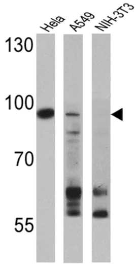 Western blot - Anti-Dnmt3b antibody (AB2851)