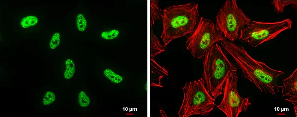 Immunocytochemistry/ Immunofluorescence - Anti-Dnmt3b antibody - N-terminal (AB227883)