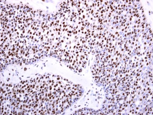 Immunohistochemistry (Formalin/PFA-fixed paraffin-embedded sections) - Anti-Dnmt3b antibody - N-terminal (AB227883)