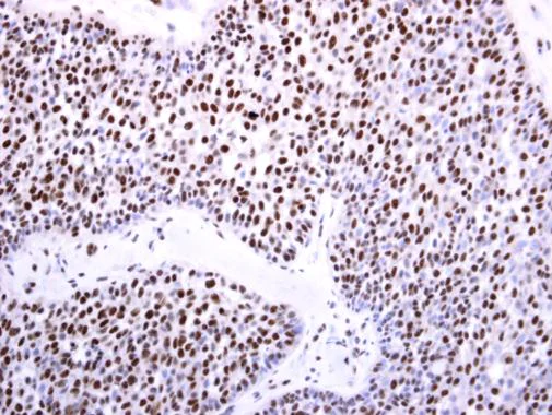 Immunohistochemistry (Formalin/PFA-fixed paraffin-embedded sections) - Anti-Dnmt3b antibody - N-terminal (AB227883)