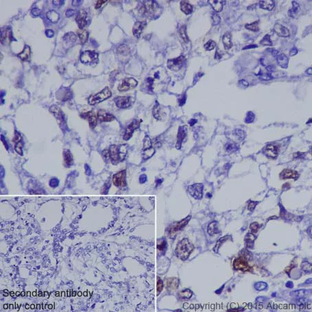 Immunohistochemistry (Formalin/PFA-fixed paraffin-embedded sections) - Anti-Dnmt3L antibody [EPR18774] (AB194094)