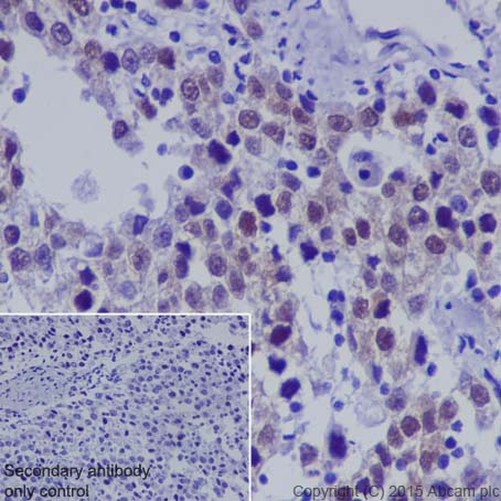 Anti-Dnmt3L antibody [EPR18774]