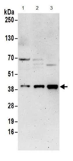 Western blot - Anti-DNTTIP1/TDIF1 antibody (AB174663)