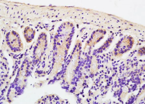 Immunohistochemistry (Formalin/PFA-fixed paraffin-embedded sections) - Anti-DOCK2 antibody (AB203068)