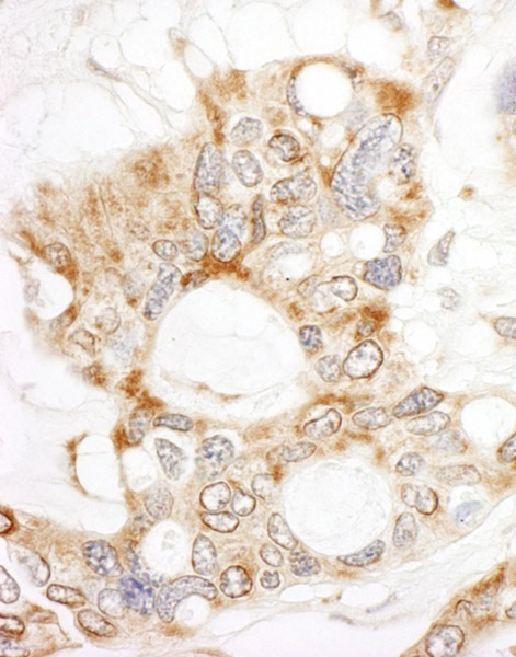 Immunohistochemistry (Formalin/PFA-fixed paraffin-embedded sections) - Anti-DOCK4 antibody (AB85723), expandable thumbnail