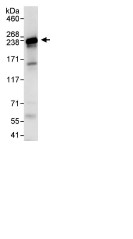 Immunoprecipitation - Anti-DOCK4 antibody (AB85723), expandable thumbnail