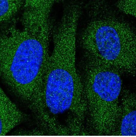 Immunocytochemistry/ Immunofluorescence - Anti-DOCK6 antibody (AB188558)
