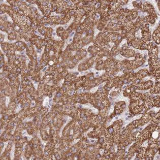 Immunohistochemistry (Formalin/PFA-fixed paraffin-embedded sections) - Anti-DOCK6 antibody (AB188558)