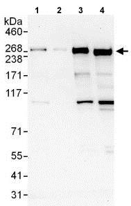 Western blot - Anti-DOCK7 antibody (AB118790)
