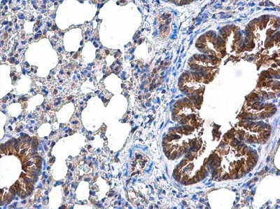 Immunohistochemistry (Formalin/PFA-fixed paraffin-embedded sections) - Anti-DOCK8 antibody (AB227529)