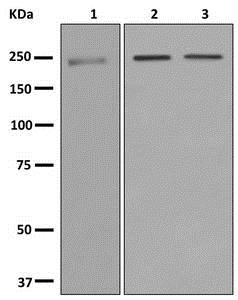 Western blot - Anti-DOCK8 antibody [EPR12511-56] (AB178427)
