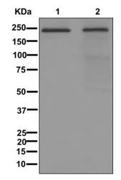 Western blot - Anti-DOCK8 antibody [EPR12511] (AB175208)