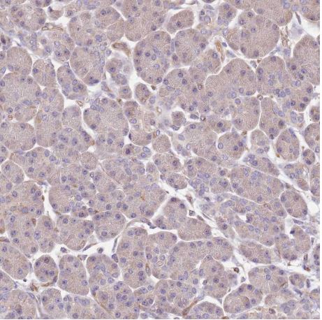 Immunohistochemistry (Formalin/PFA-fixed paraffin-embedded sections) - Anti-DOCK9/Trg antibody (AB204421), expandable thumbnail