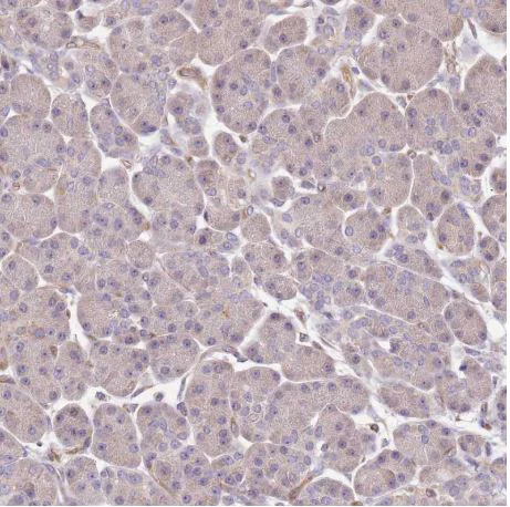 Immunohistochemistry (Formalin/PFA-fixed paraffin-embedded sections) - Anti-DOCK9/Trg antibody (AB204421)