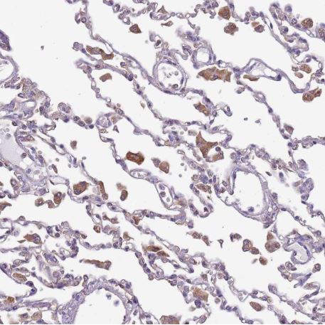 Immunohistochemistry (Formalin/PFA-fixed paraffin-embedded sections) - Anti-DOCK9/Trg antibody (AB204421), expandable thumbnail