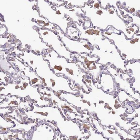 Immunohistochemistry (Formalin/PFA-fixed paraffin-embedded sections) - Anti-DOCK9/Trg antibody (AB204421)