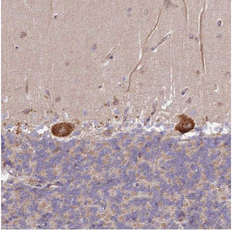 Immunohistochemistry (Formalin/PFA-fixed paraffin-embedded sections) - Anti-DOCK9/Trg antibody (AB204421), expandable thumbnail