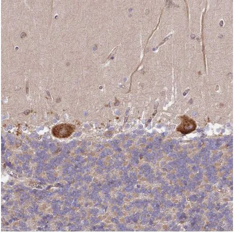 Immunohistochemistry (Formalin/PFA-fixed paraffin-embedded sections) - Anti-DOCK9/Trg antibody (AB204421)