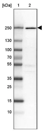 Western blot - Anti-DOCK9/Trg antibody (AB204421)