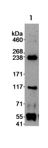 Immunoprecipitation - Anti-DOCK9/Trg antibody (AB70272), expandable thumbnail