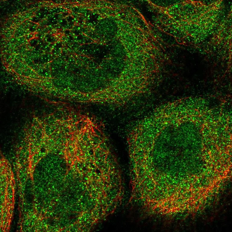 Immunocytochemistry/ Immunofluorescence - Anti-DOHH antibody (AB254866)