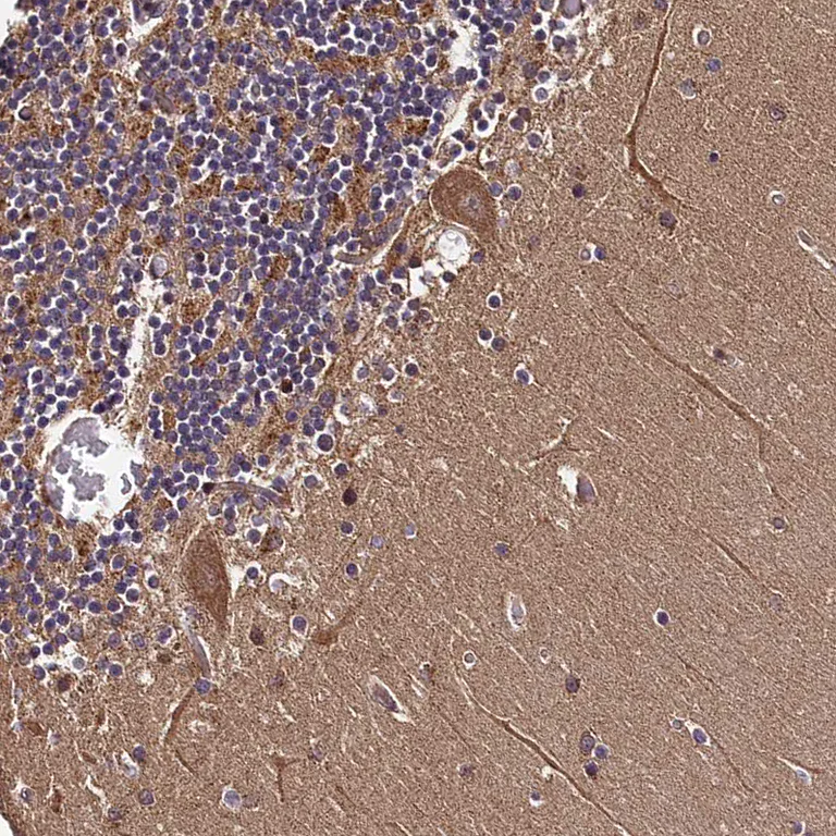 Immunohistochemistry (Formalin/PFA-fixed paraffin-embedded sections) - Anti-DOHH antibody (AB254866)