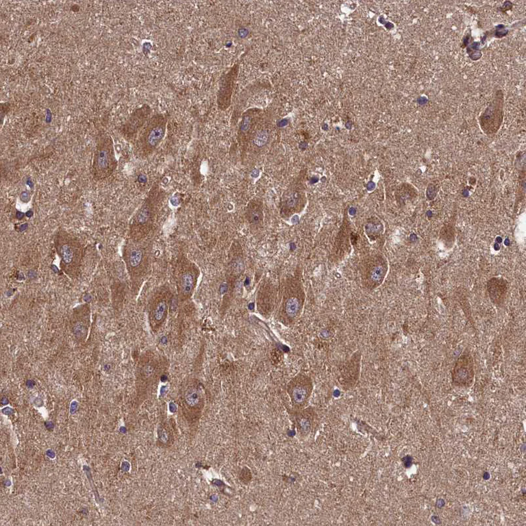 Immunohistochemistry (Formalin/PFA-fixed paraffin-embedded sections) - Anti-DOHH antibody (AB254866)