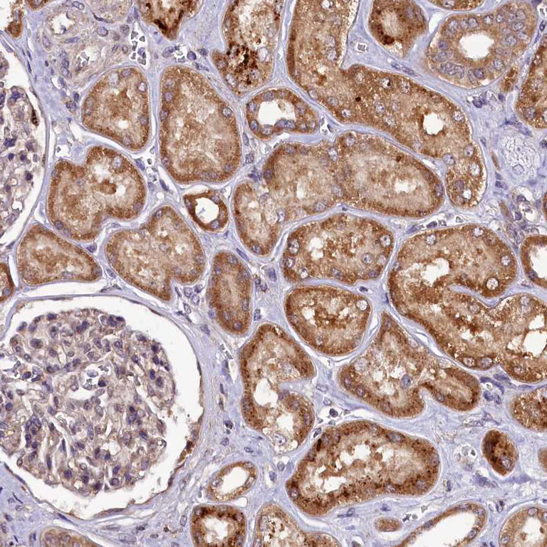 Immunohistochemistry (Formalin/PFA-fixed paraffin-embedded sections) - Anti-DOHH antibody (AB254866)